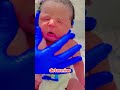 This step taken by the doctor right after the baby's birth is truly critical. #funny