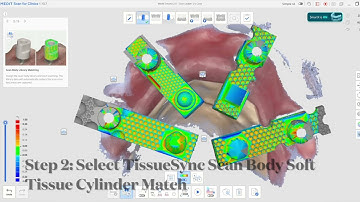 Medit SmartX 2.0 + TissueSync Tutorial | Soft-Tissue Matching for All On X Full-Arch Implant Scans