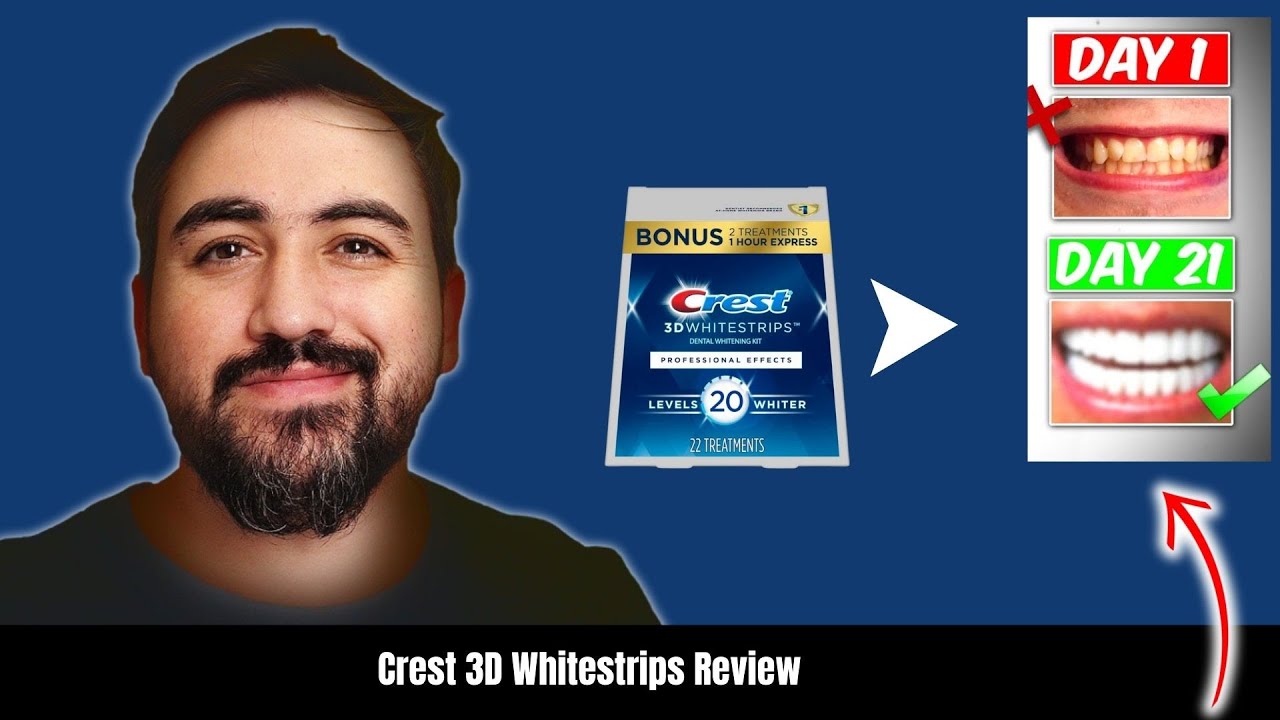 Crest 3D Whitestrips Review – Professional Teeth Whitening at Home!