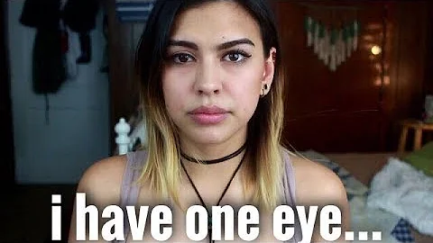 how I lost my right eye