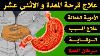 قرحة المعدة وعلاجها : دواء لقرحة المعدة و الاثنى عشر