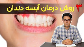 آبسه کردن لثه | درمان آبسه | آبسه در سقف دهان | آبسه لثه کودکان