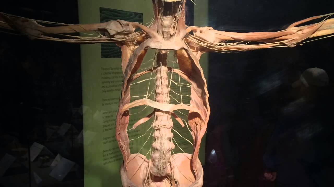 Beware! Graphic!! Pics from Body worlds vital exhibition YouTube