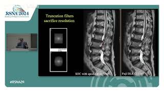 Practical Use of AI in Daily Neuroradiology Practice  Challenges and Opportuniti Medstudylab.com