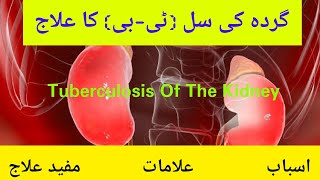 Gurda ki TB ka ilaj | Cure Tuberculosis Of The kidney by Hakeem Barkat Ali