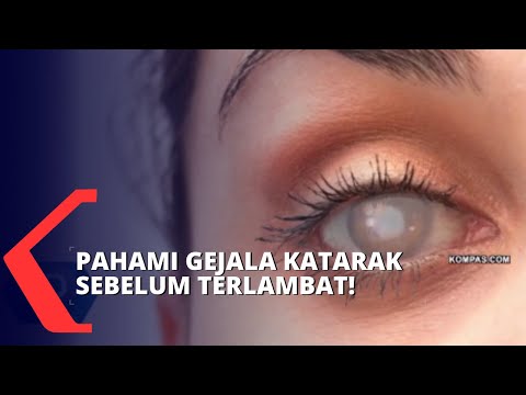 Video: 3 Cara Mendeteksi Katarak