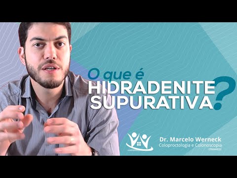 Vídeo: Hidradenite Supurativa No Rosto: Causas, Tratamento E Muito Mais