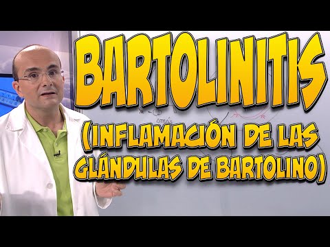 Video: ¿Desaparecerá el quiste de Bartolino?