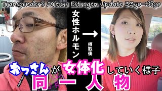 33歳～2年間でオッさんが女性に変化！ / MTF 2 Years Estrogen Update (Steroid‘s ADR & HRT )