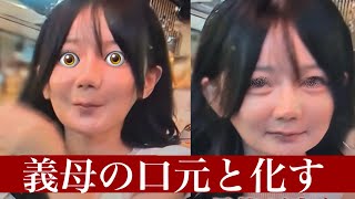 【悲報】フェフ姉さんの多◯さん、コリアで輪郭2点の顎骨切り（両顎手術）を行った結果、義母みたいな下顔面が完成する
