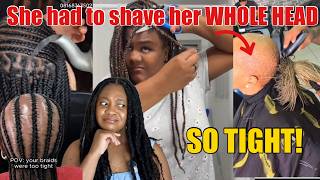 Braiders are making you BALD on purpose!