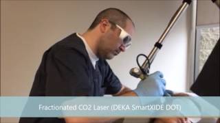 SmartXIDE DOT Laser - M. David Cole MD, FAAD - (949) 439-9288