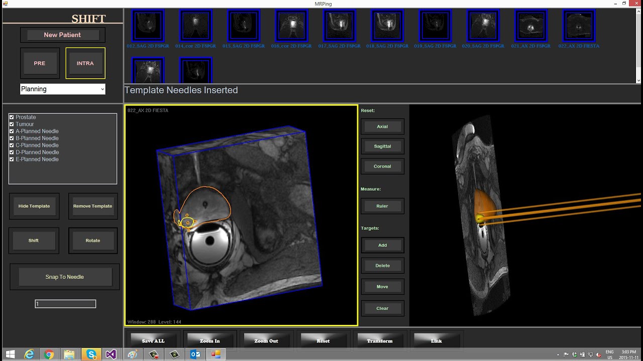 CIMTEC's software and algorithm development capabilities for medical imaging innovations YouTube