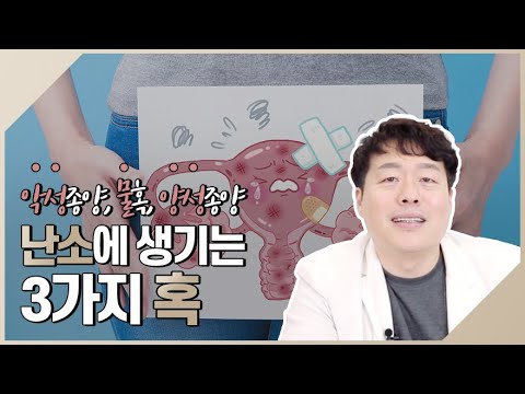 난소에 생기는 3가지 혹! 악성종양, 물혹, 양성종양