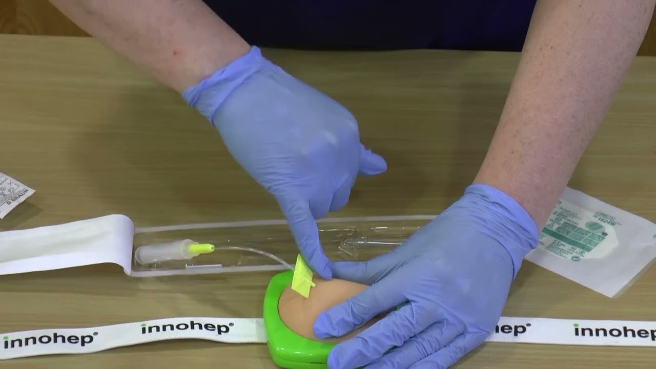 Demonstration on the insertion of a Saf T Intima for intermittent subcutaneous injections