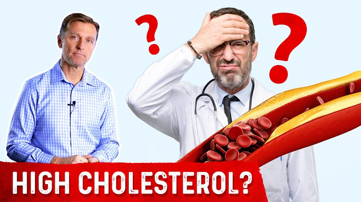 Dr. Berg's Wife Has Crazy High Cholesterol of 261.. - DayDayNews