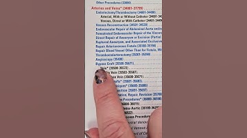Medical Coding Demonstration - How to look up a CPT code for a bypass graft #medicalcoding