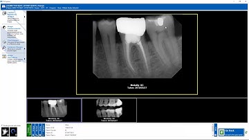 Training: Apteryx XrayVision DCV: Editing Single Image Information
