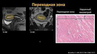 Базовый курс МРТ Лекция «МР анатомия женского таза и методика сбора данных»  Лектор  Трофименко И А