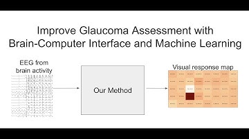 Deep Multi-Task Learning for SSVEP Detection and Visual Response Mapping