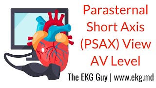 Parasternal Short Axis View (Aortic Level) - ECHO Course l The EKG Guy - www.ekg.md