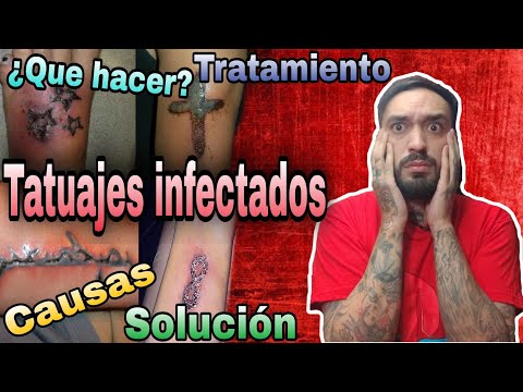 Video: 3 formas de saber si un tatuaje está infectado