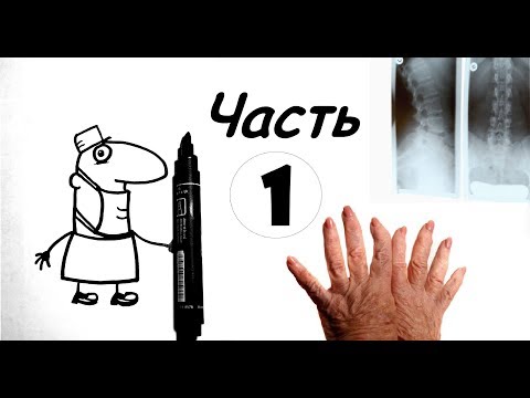 Ревматология ЗА 5 МИНУТ - Часть 1( Болезнь Бехтерева, ревматоидный артрит, реактивный артрит)