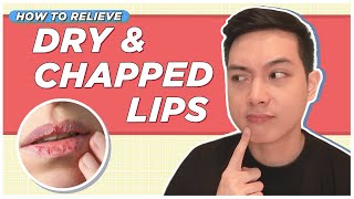 Best Ways to Relieve DRY & CHAPPED LIPS! (Filipino) | Jan Angelo