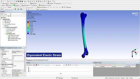 Femur Bone Structural Analysis