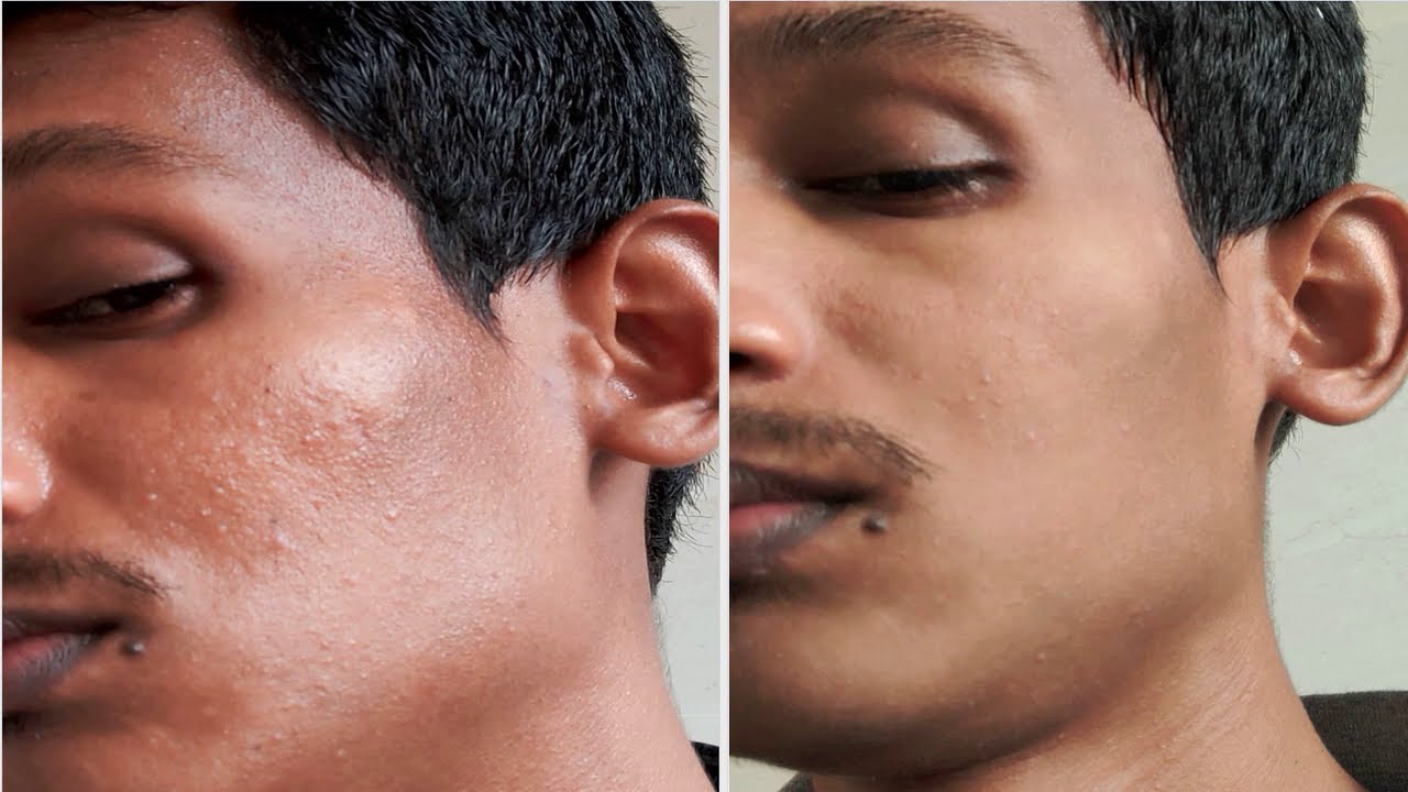 PLUM Face Wash Best Oily & Acne, Vegan Skin Care YouTube