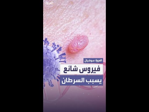 اكتشاف علمي جديد فيروس شائع يسبب أحد أخطر أنواع السرطان