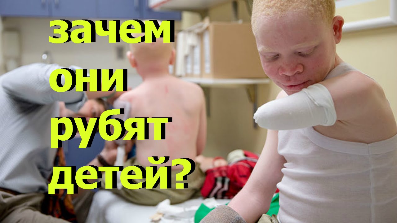 ЗАЧЕМ РУБЯТ ДЕТЕЙ - YouTube