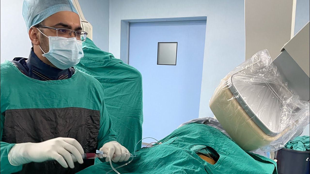 Case 5 angioplasty of octogenarian with iwmi anomalous origin rca