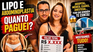 QUANTO CUSTA uma ABDOMINOPLASTIA + LIPO? A verdade que ninguém conta