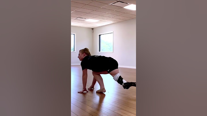 Delaney Dances with Custom Prosthetic Legs: A Rotationplasty Amputee's