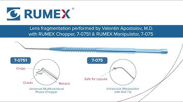 Surgery Live! Lens fragmentation by Valentin Apostolov, M.D. with 7-0751 & 7-075.