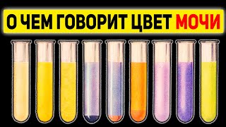 О Чем Молчит Цвет Мочи? Как по цвету мочи определить болезнь?