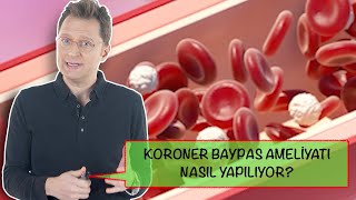 Koroner Baypas ameliyatı nedir? Nasıl yapılır?