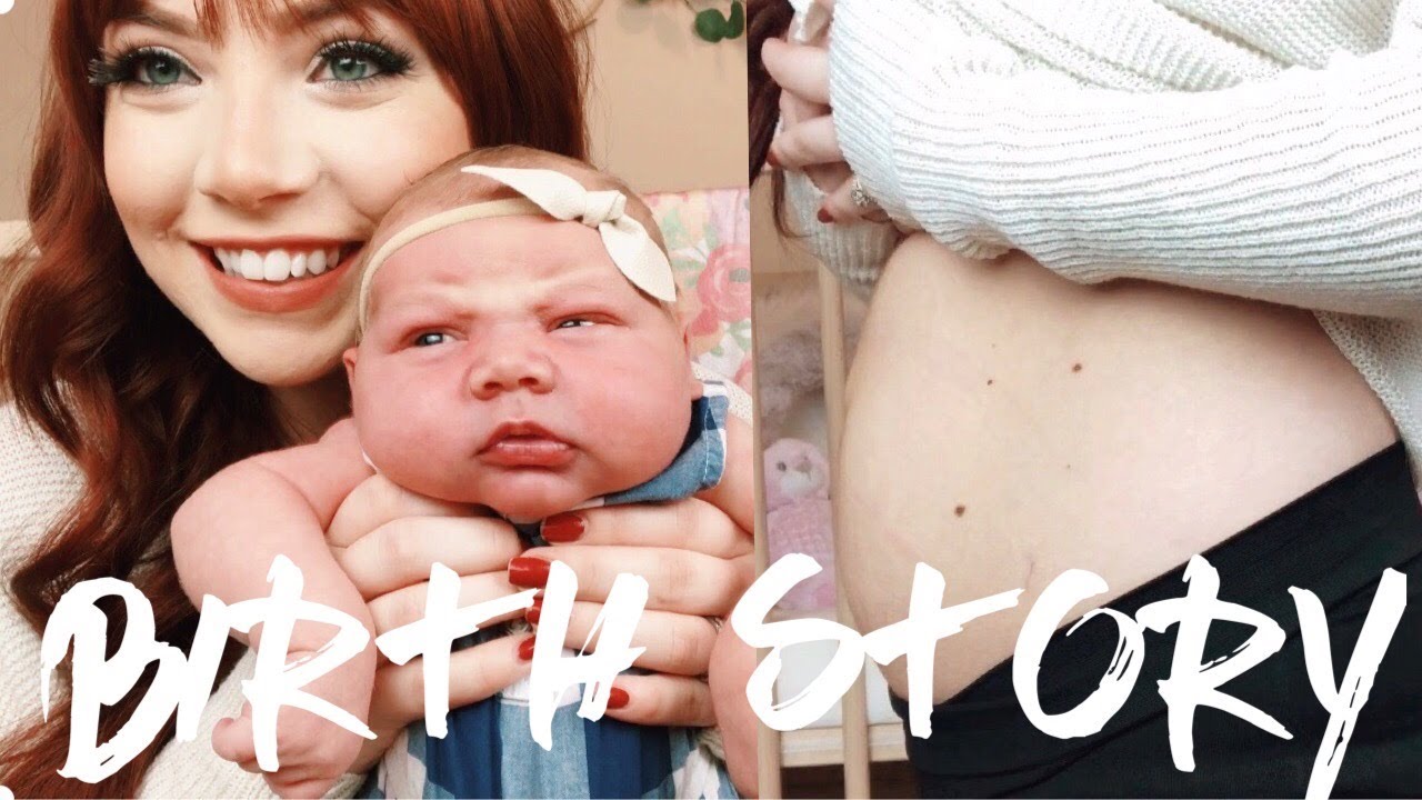MY BIRTH STORY WHAT MY STOMACH LOOKS LIKE NOW YouTube