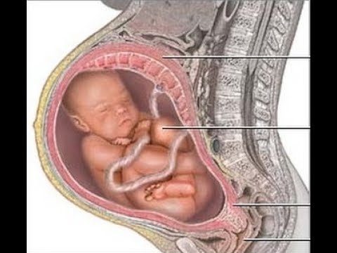 Что находится внутри плода Breech Baby Treatment - YouTube