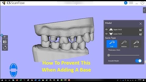 CS ScanFlow - Fixing Your Bases