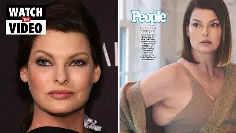 Linda Evangelista shares photos of disfigured body