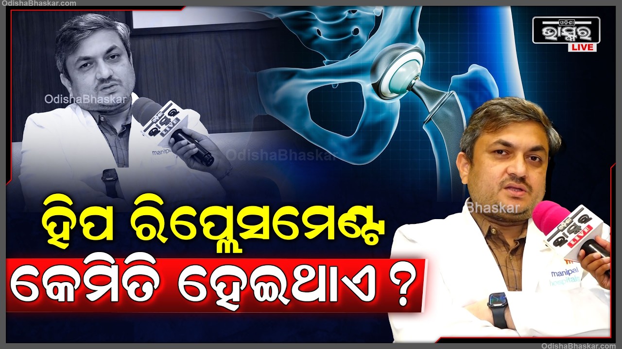 ହିପ ରିପ୍ଲେସମେଣ୍ଟ କେମିତି ହେଇଥାଏ ବୁଝେଇ କହିଦେଲେ ଡକ୍ଟର  Hip Replacement Explained