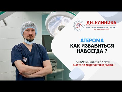 Что такое АТЕРОМА? Чем она опасна и как ее лечить? Как удаляют атеромы?