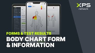Body Chart Form & Information | XPS Courses & Tutorials