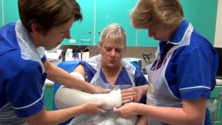 How to apply an Above Elbow Backslab