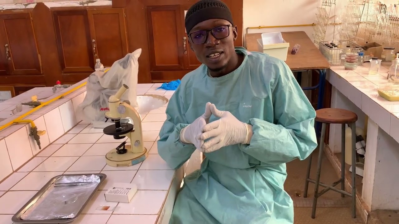 biopsie cutanée exsangue  dépistage de l onchocerciasis volvulus