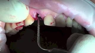 видео Стоматолог-протезист