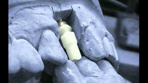Dynamic Abutments video.flv