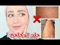 اسهل طريقه للتخلص من جلد الدجاجه في المنزل 😍🔥 ( تجربتي الشخصيه ) !! || شهد ناصر 🌸